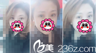 術(shù)后半個月恢復(fù)情況 術(shù)后半個月恢復(fù)情況