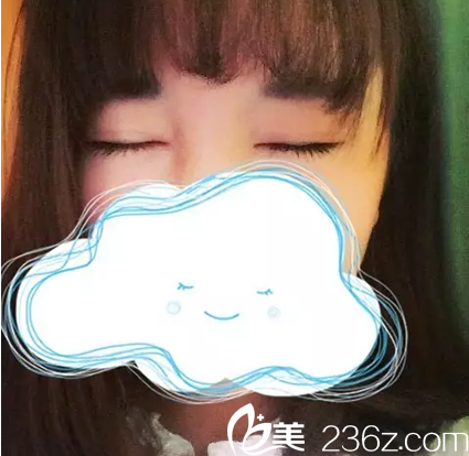 雙眼皮術(shù)后一個(gè)月閉眼恢復(fù)情況