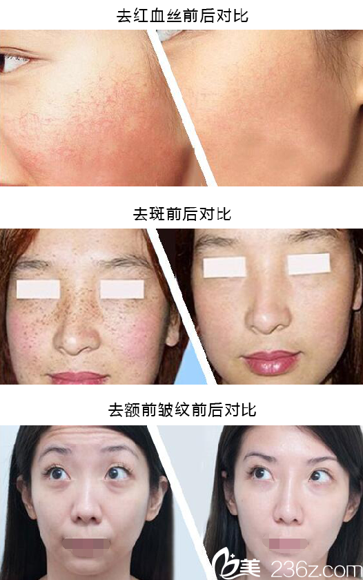 整形案例前后對比