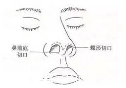 鼻綜合整形簡介 鼻綜合整形簡介