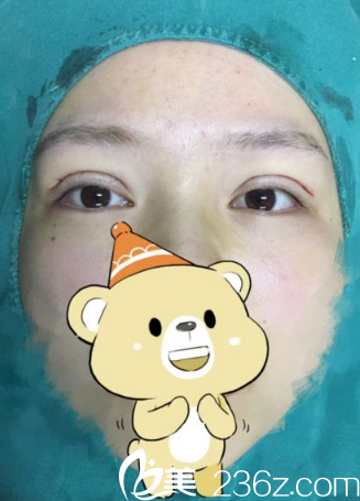 冶春梅醫(yī)生給我手術(shù)噠