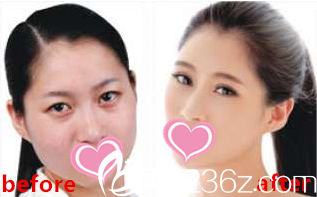面部整體形象設(shè)計(jì)前后對(duì)比 面部整體形象設(shè)計(jì)前后對(duì)比