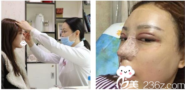 李光琴醫(yī)生面診過程 李光琴醫(yī)生面診過程