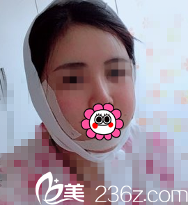 手術(shù)當(dāng)天照片 手術(shù)當(dāng)天照片