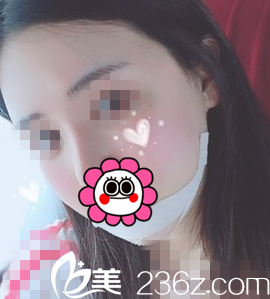 術(shù)后第十天回國(guó) 術(shù)后第十天回國(guó)