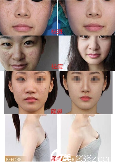 重慶光博士整形真人