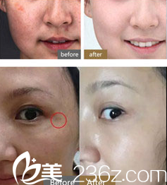 20180323_1521794849382514.png blob.png