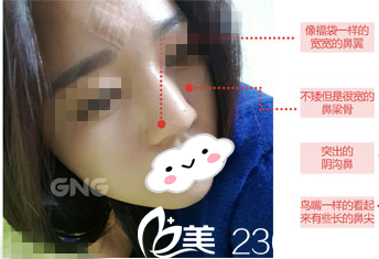 手術(shù)前的我 手術(shù)前的我