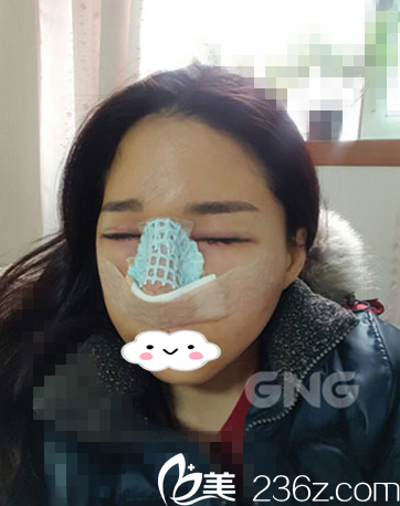 術(shù)后第三天 術(shù)后第三天