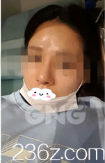 術(shù)后一周 術(shù)后一周