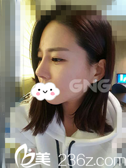 術(shù)后兩周 術(shù)后兩周