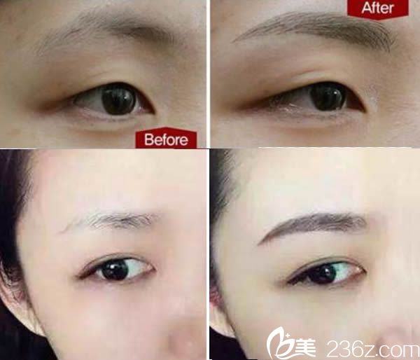 廈門華美陳燕喜半紋眉前后對比案例