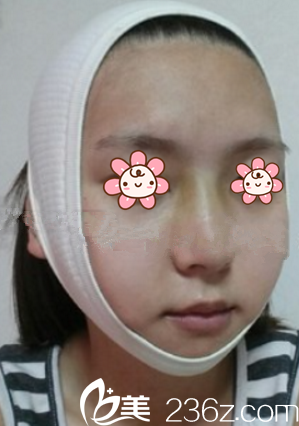 術(shù)后第三天 術(shù)后第三天