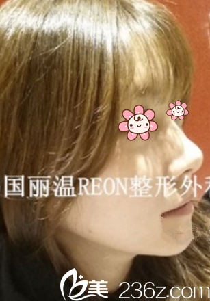 十天效果 十天效果