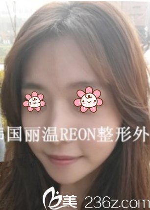 大半個(gè)月后心情好a 大半個(gè)月后心情好a