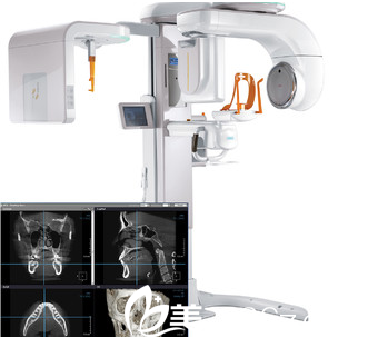 先進的3D-CT儀器