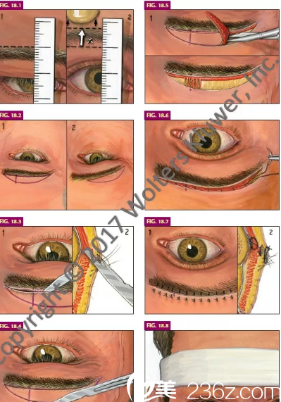 眉毛的各種樣子