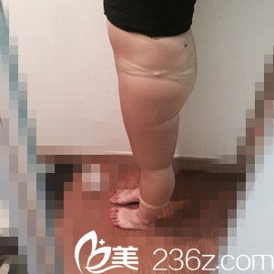 手術(shù)前的我 手術(shù)前的我