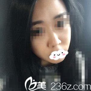 術(shù)后第十五天 術(shù)后第十五天