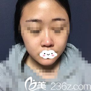 手術(shù)前的我 手術(shù)前的我