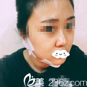 術(shù)后第四天 術(shù)后第四天