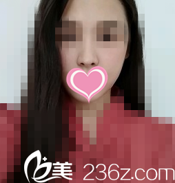 追求完美的我還是決定在韓國NJH盧鐘勛整形醫(yī)院做顴骨整形術來實現我的美麗夢！