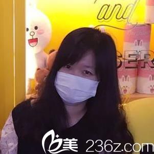 注射瘦臉第2天面部微腫