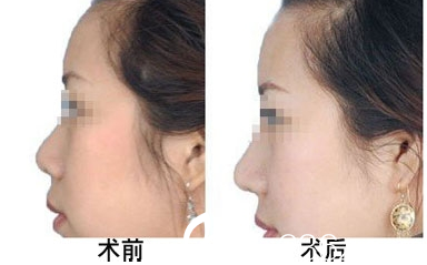 懷化華美醫(yī)療美容醫(yī)院<span style= 懷化華美醫(yī)療美容醫(yī)院<span style=