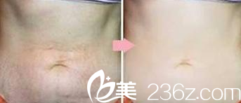 懷化華美醫(yī)療美容醫(yī)院<span style= 懷化華美醫(yī)療美容醫(yī)院<span style=