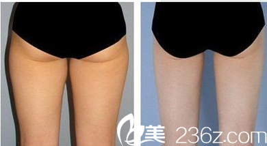 懷化華美醫(yī)療美容醫(yī)院<span style= 懷化華美醫(yī)療美容醫(yī)院<span style=