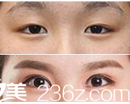 懷化華美醫(yī)療美容醫(yī)院<span style= 懷化華美醫(yī)療美容醫(yī)院<span style=