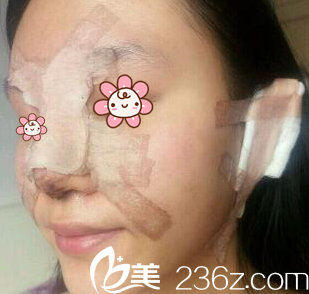 宋寅洙院長給我手術(shù)完第二天