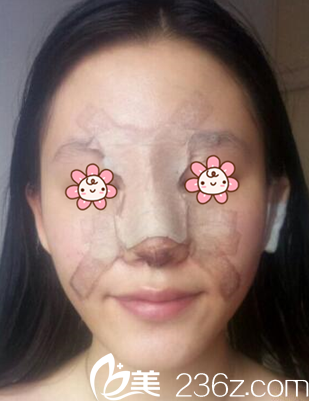 術(shù)后第四天