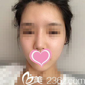 術前照片 術前照片