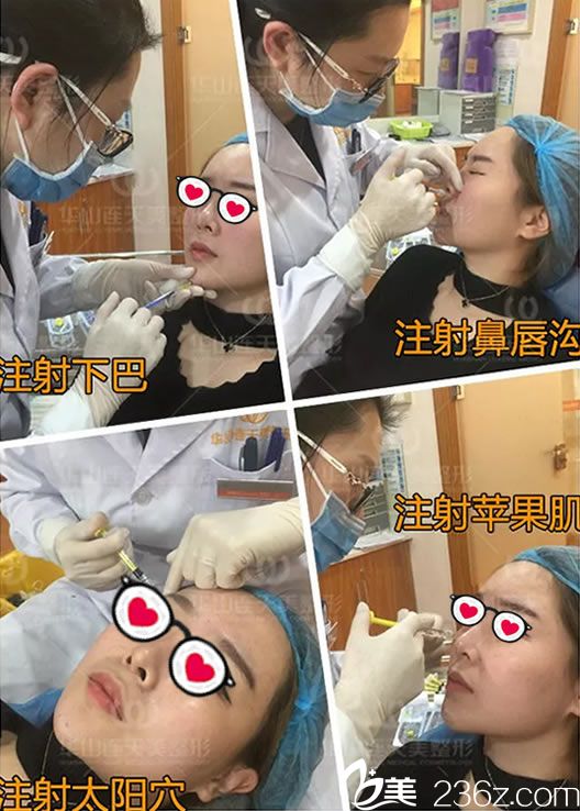 義烏連天美玻尿酸注射全過(guò)程 義烏連天美玻尿酸注射全過(guò)程