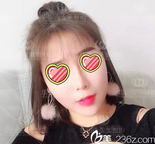 注射玻尿酸填充手術(shù)第1天<span style= 注射玻尿酸填充手術(shù)第1天<span style=