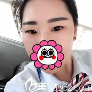 術(shù)前樣貌 術(shù)前樣貌