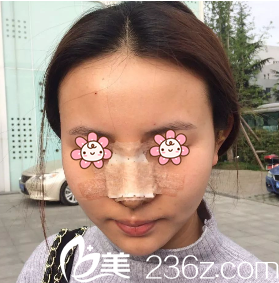 院長安相泰親自給我做的手術(shù) 院長安相泰親自給我做的手術(shù)