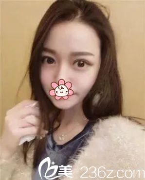 半個(gè)多月過(guò)去了，沒(méi)什么不舒服