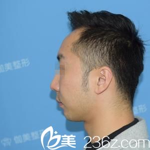 20180410_1523350863777278.jpg 20171121153652150_301_301.jpg