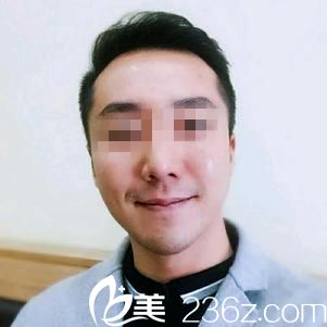 術(shù)后七天效果 術(shù)后七天效果