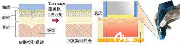 尹珍惠 熱瑪吉 尹珍惠 熱瑪吉