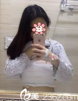 術后第二天 術后第二天