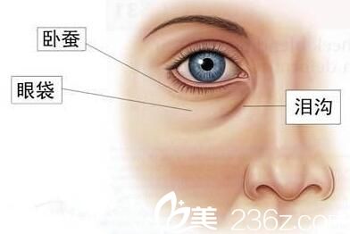 有了眼袋顯老十歲？松原齊飛4種祛眼袋手術5990元起老幫你