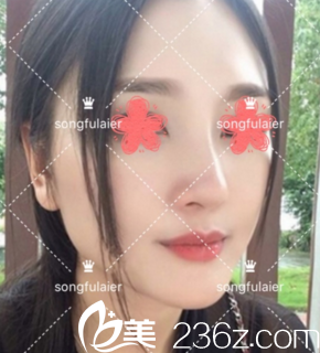 術(shù)后一周 術(shù)后一周