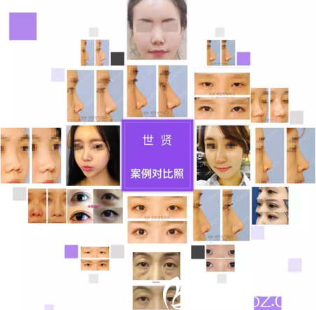 世賢修復(fù)案例展示