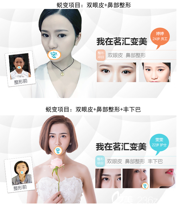 綿陽(yáng)茗匯醫(yī)療美容醫(yī)院部分塑美案例 綿陽(yáng)茗匯醫(yī)療美容醫(yī)院部分塑美案例