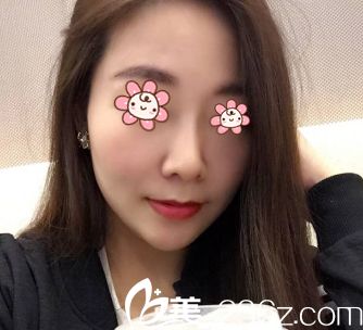 韓國Cocoline整形做無假體隆鼻+耳軟骨墊鼻尖的這院長名字真逗