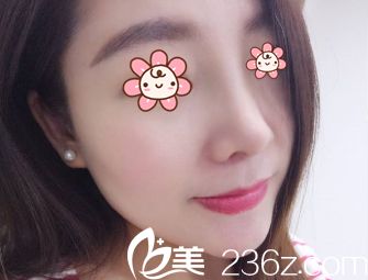 我媽朋友夸我標致，哈哈