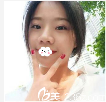 轉(zhuǎn)眼去珠?？泼雷鲭p眼皮12天了